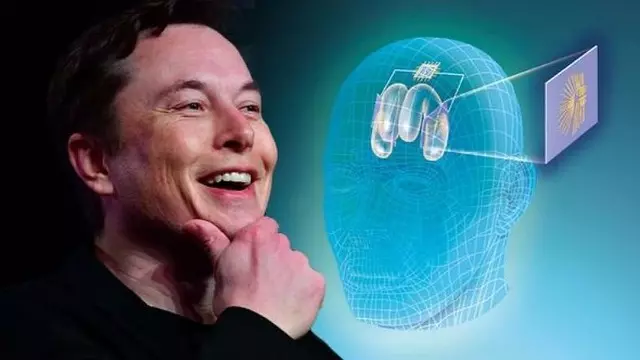 Elon Musk: Çalışan Bir Neuralink Cihazı Göstereceğiz