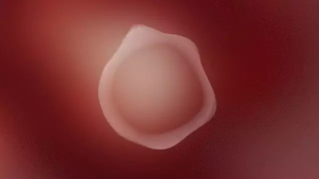 Sesli Asistan Q, Ayrımcılıkla Mücadelenin Sembolü Oldu