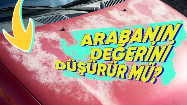 Arabada Güneş Yanığı Neden Olur, Nasıl Geçer?