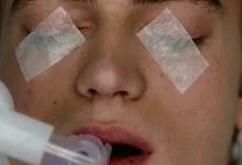 Filmlerde Gördüğümüz, Gerçekte Yanlış Olan 6 Sağlık Klişesi