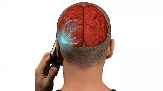 Türkiye'de Satılan Popüler 47 Akıllı Telefonun SAR Değerleri