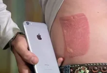 Telefonun Aşırı Isınmasına Neden Olan Sorunlar ve Çözümleri